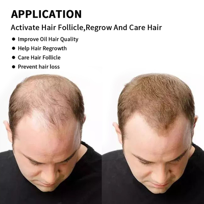 comprar chapéu leve vermelho do laser da rebrota do cabelo do tampão 660nm 850nm 940nm da terapia 75W fabricação em linha
